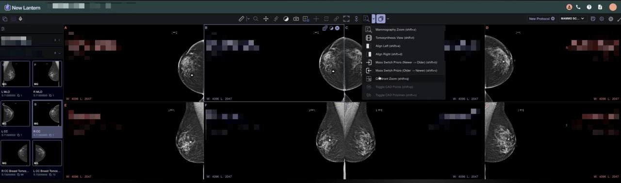 Mammography toolkit