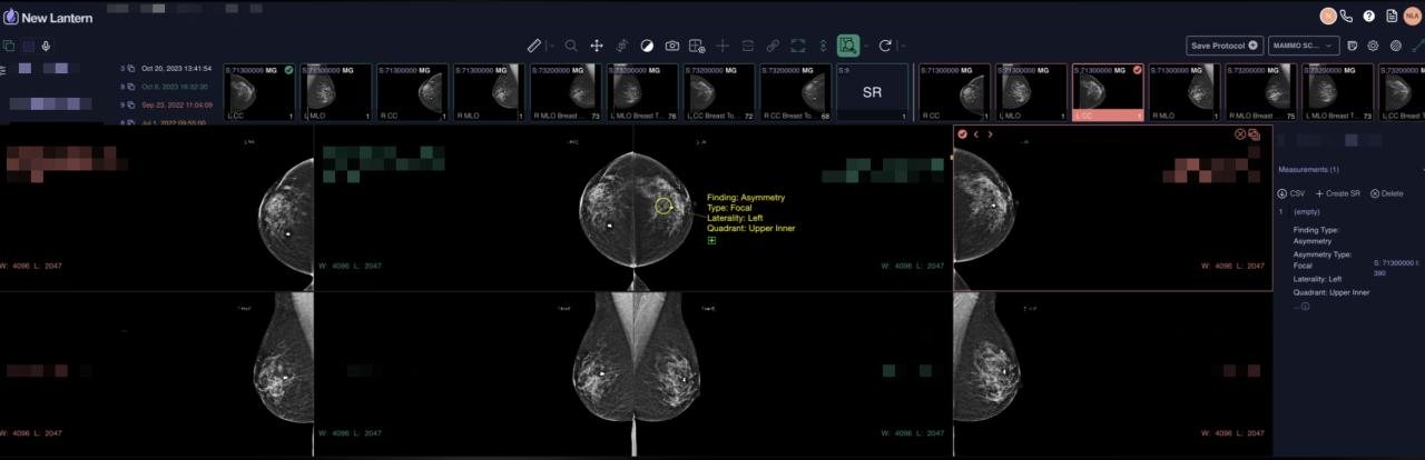 Mammography viewer