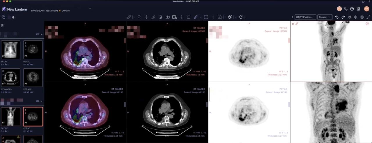 PET/CT and PET/MR viewer